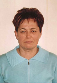 Chirurgia Estetica - addominoplastica foto prima dopo.