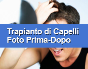 Vai alla sezione Trapianto di capelli, foto prima-dopo.